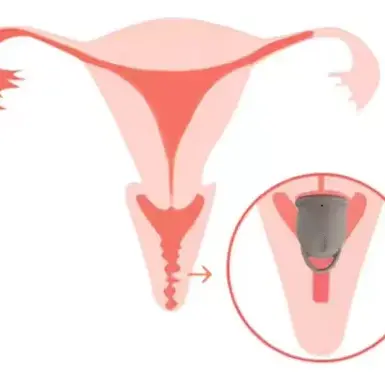 Copa menstrual Roblis & Flip (incluye bolsita y su recipiente esterilizador alta calidad 200ml)'s photo #3