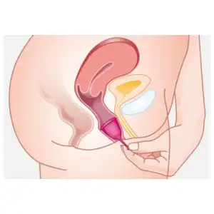 Copa Menstrual Tulipa Alemana miniatura 5